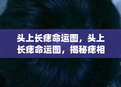 揭秘头上长痣命运图,痣相与人生轨迹的微妙联系探索命运密码
