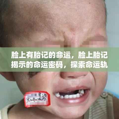 脸上胎记与命运密码，揭示命运轨迹的独特印记探索