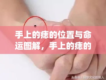 手上痣的位置与命运图解,揭示痣相深层含义的奥秘