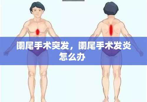 阑尾手术突发,阑尾手术发炎怎么办